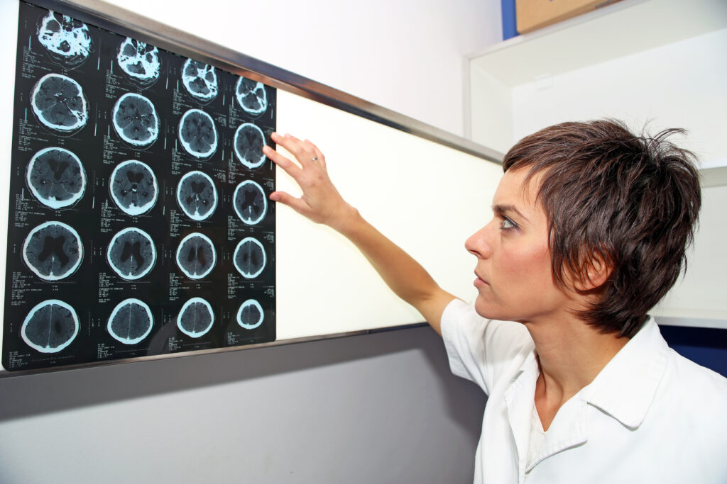 follow up imagining in MRI